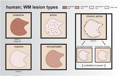 High-Resolution Transcriptomic and Proteomic Profiling of Heterogeneity of Brain-Derived Microglia in Multiple Sclerosis